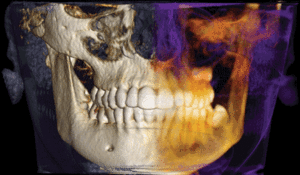 Precise view into your patient's anatomy and tools to plan their care.