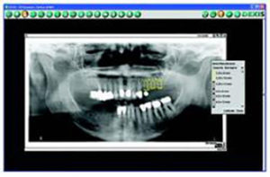 Figure 5-Digital X-rays and photos give impact to case presentation