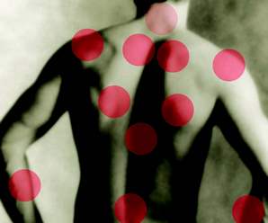 Muscle points of pain