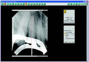 From ‘0’ to X-ray in under 6 seconds