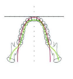 A better path for a better image