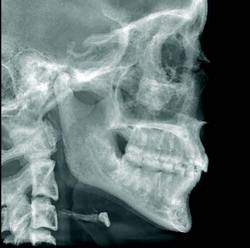 Cephalometric Image