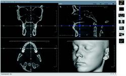 Multi-Planar Reconstruction