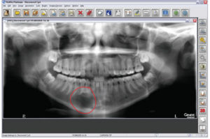 Instant, high-resolution digital X-rays–a practice essential