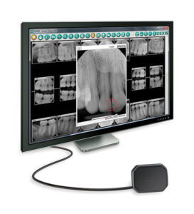 DEXIS Platinum Sensor