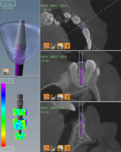 i-CAT data in E4D Compass