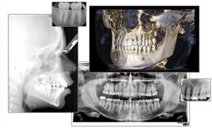 Gendex — your total imaging solutions provider