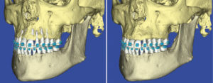 An exciting and enhanced world lies ahead for orthodontists who implement 3-D imaging.