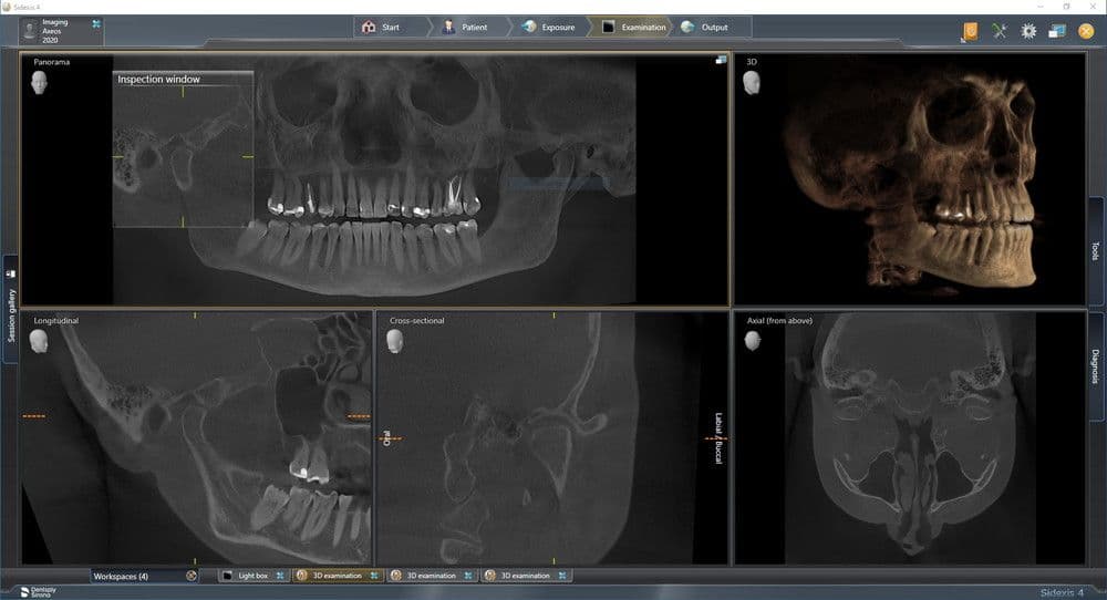 Axeos 17x13 HD-X-ray