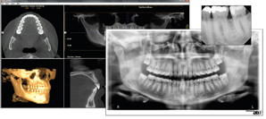Digital imaging–clinically and financially enhancing the practice