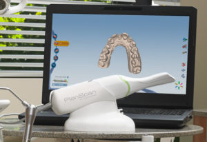 Planmeca PlanScan provides chairside cad/cam