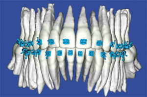 i-CAT data in SureSmile