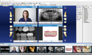 Dentrix G7 interface