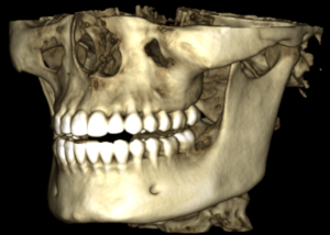 CBCT units produce 3D images, which offer very high spatial resolution compared to virtually any other type of scan.