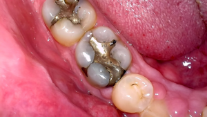 Image from high-definition cameras